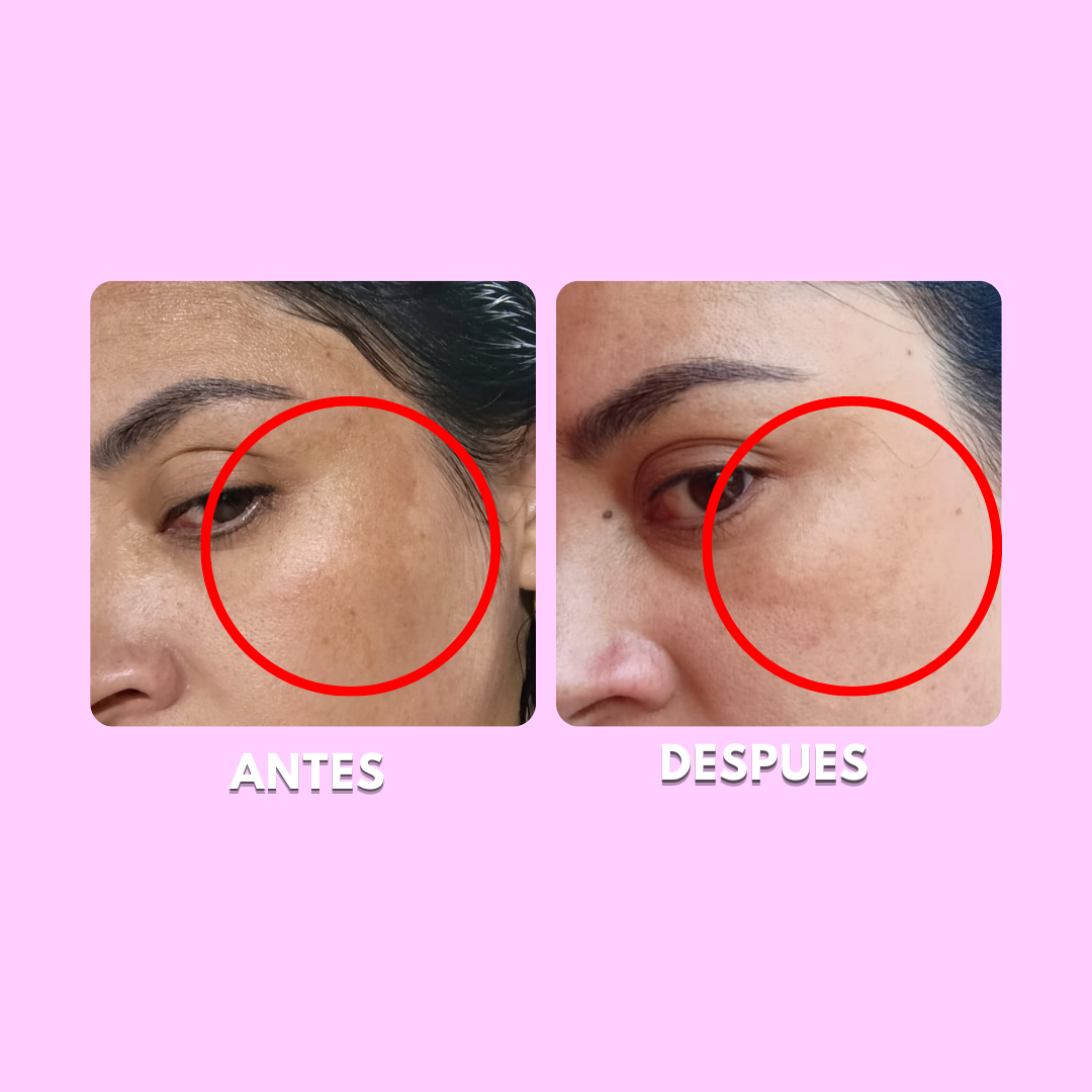 Pack Despigmentante - Retinol y Vitamina C