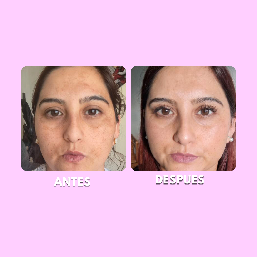 Pack Despigmentante - Retinol y Vitamina C