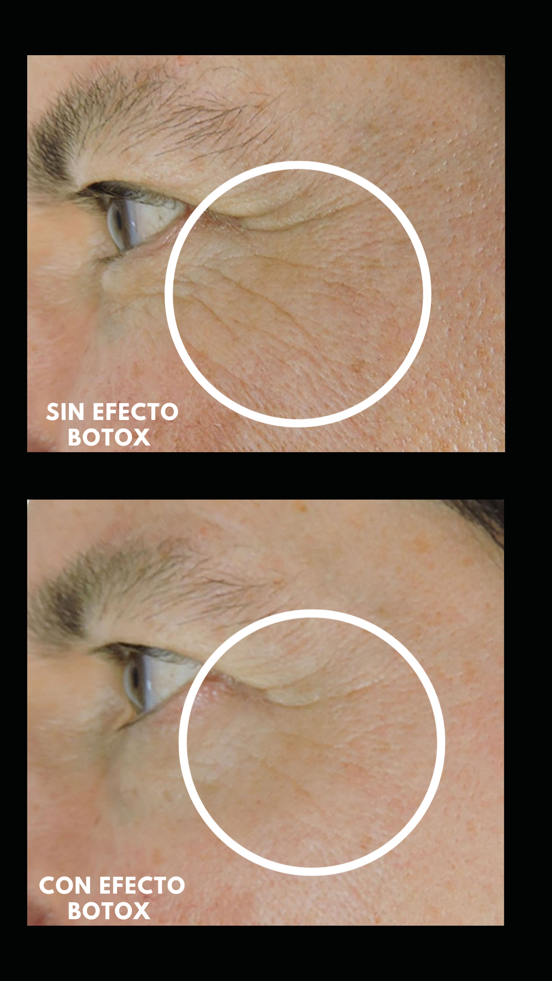 Pack Efecto Botox - Tratamiento con péptidos para líneas de expresión.