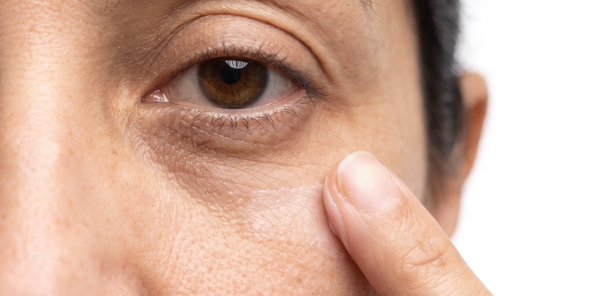Mujer aplicando crema bajo el ojo