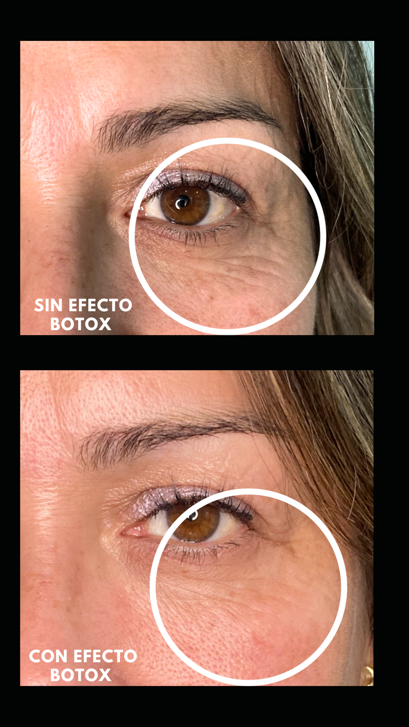 Pack Efecto Botox - Tratamiento para líneas de expresión
