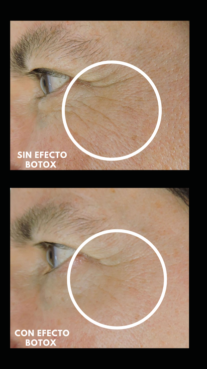 Pack Efecto Botox - Tratamiento con péptidos para líneas de expresión.
