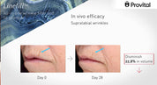 Crema Cosmo - Tratamiento liporellenador de arrugas
