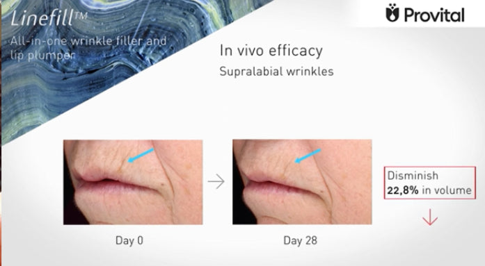 Crema Cosmo – Tratamiento liporellenador para contorno de ojos y labios