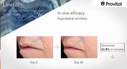 Crema Cosmo – Tratamiento liporellenador para contorno de ojos y labios