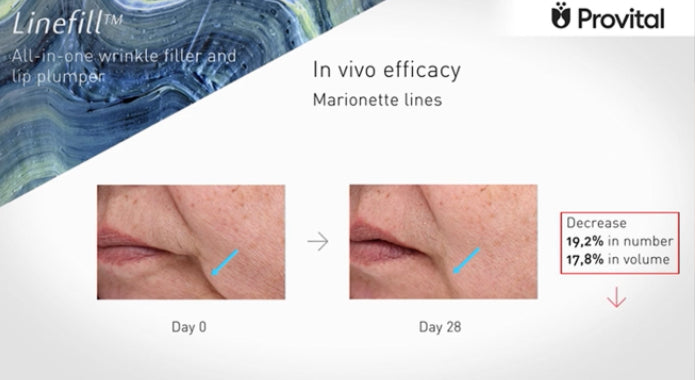 Crema Cosmo - Tratamiento liporellenador de arrugas
