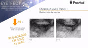 Crema Cosmo - Tratamiento liporellenador de arrugas