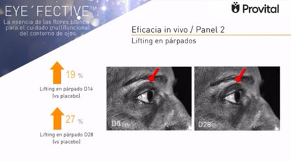 Crema Cosmo – Tratamiento liporellenador para contorno de ojos y labios