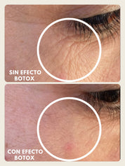 Antes y después de una clienta: contorno de ojos sin y con el Pack Efecto Botox