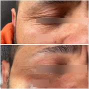 Booster Efecto Botox - ARG-AH
