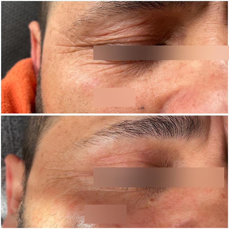 Booster Efecto Botox - ARG-AH