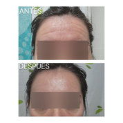 Booster Efecto Botox - ARG-AH