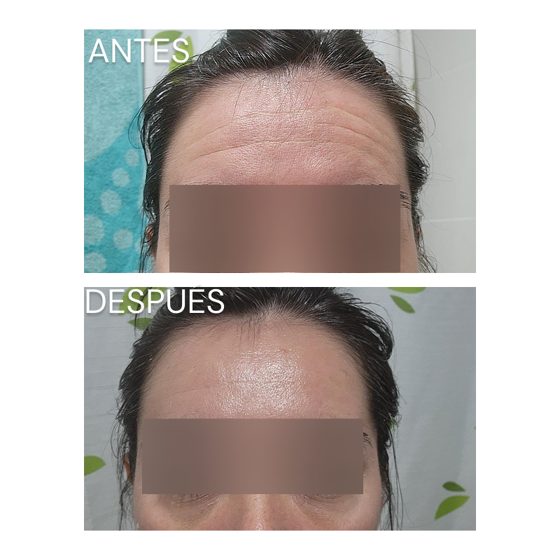 Booster Efecto Botox - ARG-AH